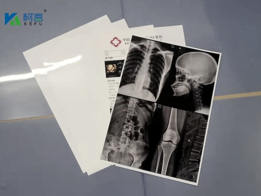 “ weiße 180 Mikrometer HAUSTIER 13X17 X Ray Film Sheets Transparency Film für Tintenstrahl-Drucker