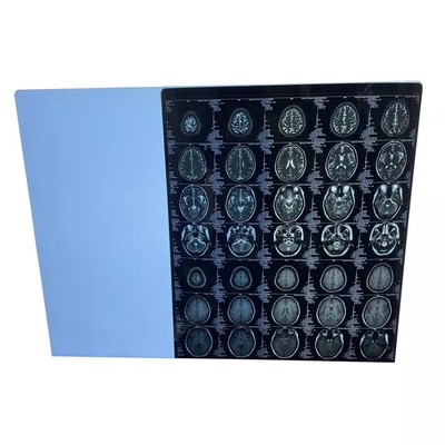 Statischer medizinischer trockener Film-Fuji-Laser-Darstellungs-Antifilm 25cmx35cm