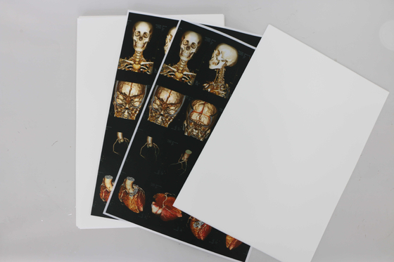 Zoll ISO14001 Digital X Ray Film Medical X Ray Film 10x12