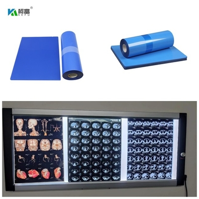 Medizinische X Ray Film 210 Micorn 10inch Rolle 8x10 14x17 A4 A3 100 des blauen Basis-Tintenstrahl-bedeckt