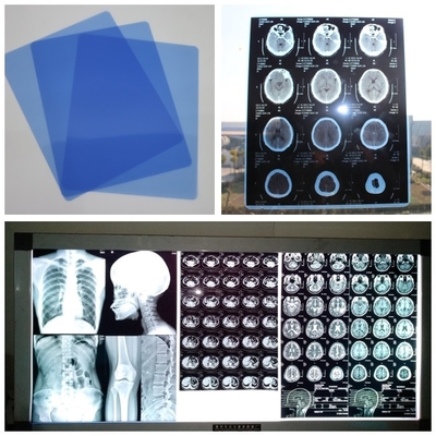 Kassette des Tintenstrahl-210um medizinische X Ray Film Blue For Digital Dr CT MRI mit Blättern 8x10
