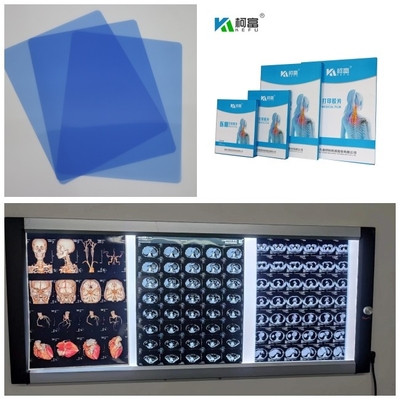 Medizinisches X Ray Film 3D Bild CT Dr MRI Tintenstrahl-gab Zoll 8x10 11x14 14X17 aus