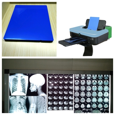 Inkjet-Röntgenfilm 8x10 10x12 11x14 14x17 A4 A3 A3+ 13X17 mit Druckgeschwindigkeit 1-3 Minuten