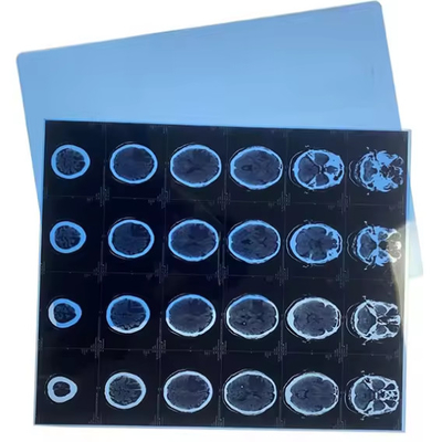 Klare und genaue Ergebnisse mit medizinischen Röntgenfilmen aus PET-Filmbasis