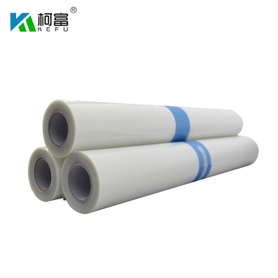 17&quot; Toner-Laserdruck-Film HAUSTIER X30m-Weiß-Lasers X Ray Film Rolls