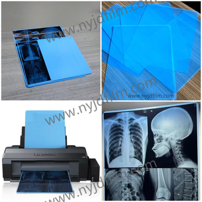 210 Mikrometer blaue X Ray Film Medical Inkjet Printing Film-für Krankenhaus