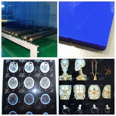 ISO 9001 24 medizinischer X Ray Film Blue Laser Transparency Film des Zoll-X 30m für Krankenhäuser