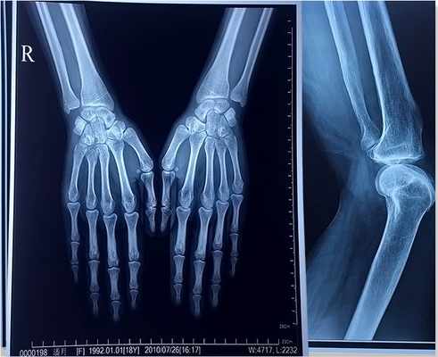 ISO 9001 24 medizinischer X Ray Film Blue Laser Transparency Film des Zoll-X 30m für Krankenhäuser