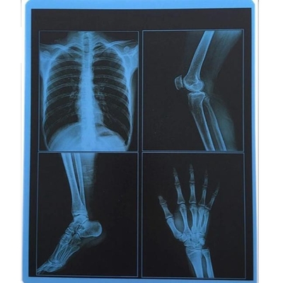 25cm x 30cm blauer Transparenz HAUSTIER thermischer Film-medizinischer trockener Darstellungs-Film für Krankenhaus