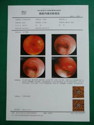 HAUSTIER basiertes medizinischer trockener Film-weißes Tintenstrahl X Ray Film 125um 150um 180um Soem