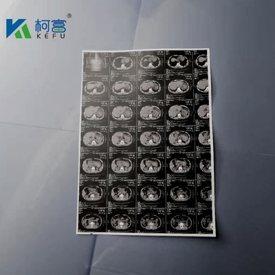 medizinischer X Ray Film Canon Epson Inkjet Drucker Film 180um A3 weißen Tintenstrahl-