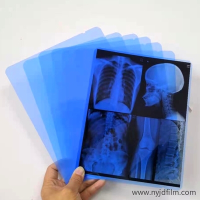 wasserdichte blaue X Ray Film For Hospital Radiology des Zoll-13x17 Abteilung Lasers