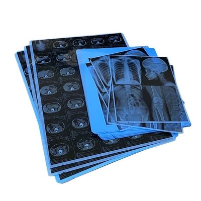 wasserdichter medizinischer trockener des Film-210um Zoll Tintenstrahl-Druckdes film-14x17