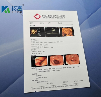 Weißer glatter Film A4 B5 16K 125um Tintenstrahl-X Ray Film Medical Dry Imaging