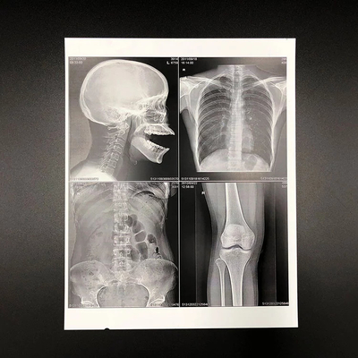 Freundliches HAUSTIER Eco basierte medizinischer trockener Film-weißen Tintenstrahl X Ray Film 150 Mikrometer