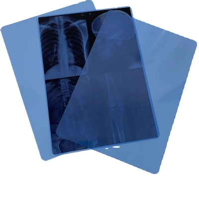 Soem-Radiologie HAUSTIER X Ray Film 11x14 Zoll-Toner-Laserdruck-medizinischer blauer Film