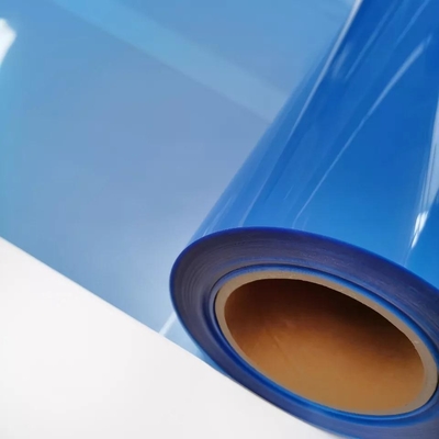 Papier des Zoll-13x17 trockenes blaues X Ray Medical Film Blue Transparency für Laserdrucker