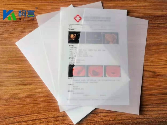 Drucklaser-Röntgenfilm hervorragende UV-Widerstandsfähigkeit und gute Feuchtigkeitsbeständigkeit