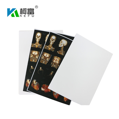 Medizinischer X Ray Film 35x43CM 10x12 Drucker der blauen weißen Basis-des Zoll-X Ray Dry Film For Fuji