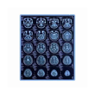 Zoll HAUSTIER der Entschließungs-320dpi basierte medizinisches trockenes des Film-10x12 Thermal-Drucker Film