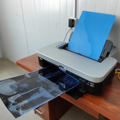 35x43CM Blaue medizinische Röntgenfilm für CT-MRT-Bildmodelle