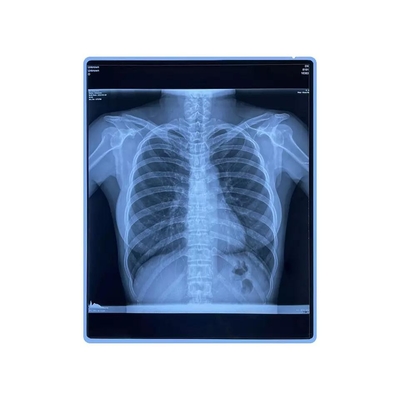 CER Zoll-Haustier-Tintenstrahl-Film bedruckbaren Blau-medizinischer X Ray Film 11x14