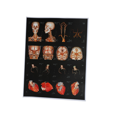 Tintenstrahl X Ray Film Soems 210um