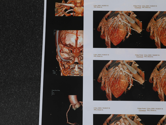 240gsm 180 Kasten-Film des Mikrometer-medizinischer Tintenstrahl-Film-3D CT umweltfreundlich