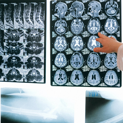 Farbstrahlblaue medizinische Trockenfolie Transparente blaue Röntgenfolie für CT-DR-MRT-Radiologiegerät