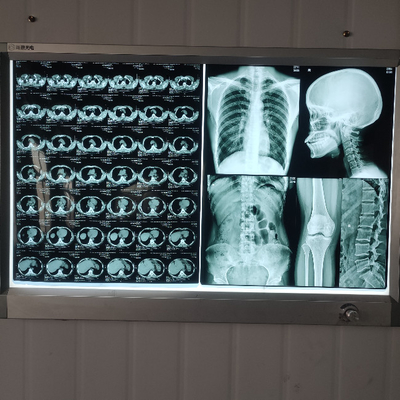 Harz A4 A3 medizinischer Röntgenfilm für Radiologiegrafiken