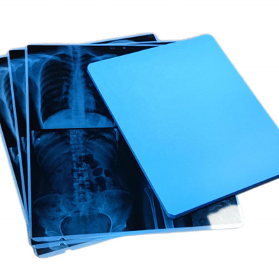 Zoll X Ray Dry Film And Screen Dicom-Druck-10x12 für Diagnosedarstellung