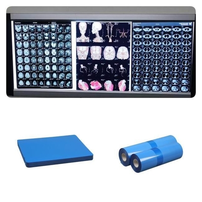 Medizinischer Tintenstrahl X Ray Films Dr CT MRI 210 Mikrometer blaues niedriges der Tinten-8x10 A4 A3 10inch Rollen-