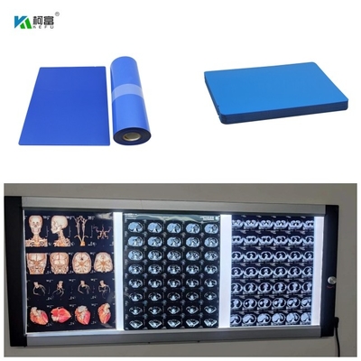 Film 8x10 13x17 14x17 A4 A3 100 des 210 Mikrometer-Tintenstrahl-X Ray Medical Blue Base Dry bedeckt