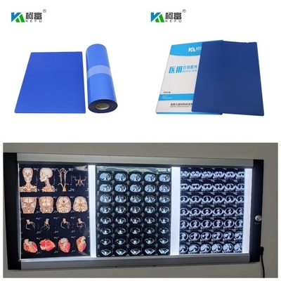 Medizinische blaue niedrige Färbungs-Tinte 14inch X des Tintenstrahl-X Ray Film Dr CT MRI 125 Blätter rollen 10x12