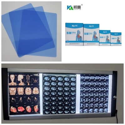 Blauer niedriger medizinischer Tintenstrahl-trockener Film Dr CT MRI X Ray 210 Mikrometer 8x10 A4 A3 14inch Rollen-