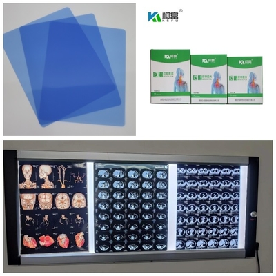 Medizinischer Tintenstrahl X Ray Films Dr CT MRI 210 Mikrometer blaues niedriges der Tinten-8x10 A4 A3 10inch Rollen-