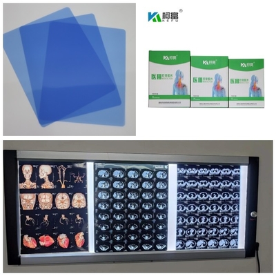 Ertrag 280gsm medizinisches X Ray Film Inkjet Blue Base für Bild 10x12 11x14 A4 A3 Dr CT MRI