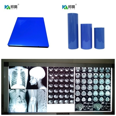 280gsm medizinischer trockener Farbbild-Ertrag des Tintenstrahl-X Ray Film Blue Base Digital