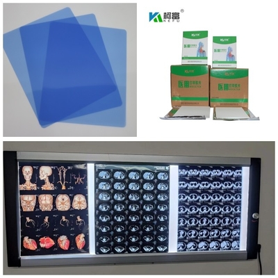 Medizinischer Tintenstrahl X Ray Film Blue Base With 280gsm Digital für 14x17inch A4 wasserdicht