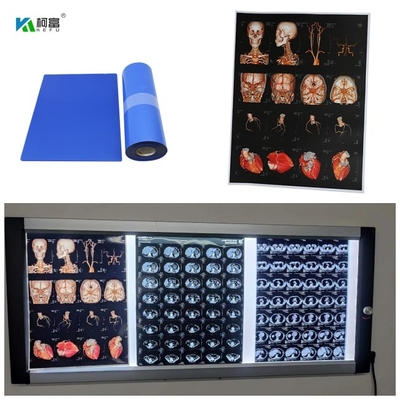 Blauer niedriger medizinischer Tintenstrahl X Ray Film For Digital Image 280gsm für Bild der Farbe14x17inch