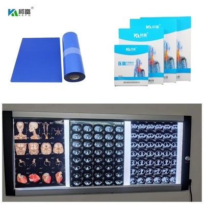 Medizinischer Tintenstrahl-blaue Basis X Ray Film Digital Image With 210um für 14x17inch