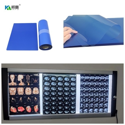 210microns Tintenstrahl medizinisches X Ray Film For CT Dr MRI und 3D CT MRI Bild gab 14x17 aus
