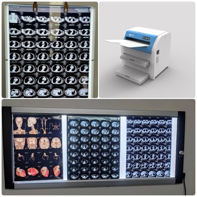 11x14 14x17 medizinische trockene Fujifolie mit maximaler Übertragungsdichte ≥ 3,0 D