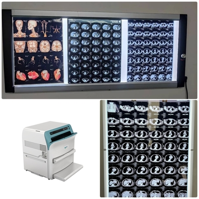 Medizinische hochauflösende Röntgenstrahltrockenfilm 10x12 für DR CT MRT DSA-Bild-Ausgabe kompatibel mit Fuji-Drucker