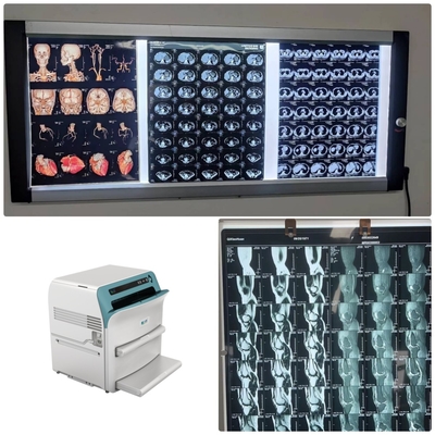 Medizinisches X Ray Film Radiology 14*17 Zoll-Krankenhaus-blauer thermischer Film der Klassen-I