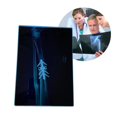 Thermischer medizinischer Trockendruckmaschine CT-Drucker Tintenstrahlfilm Blau A4 PET Orthopädische medizinische Ausrüstung Röntgenfilme