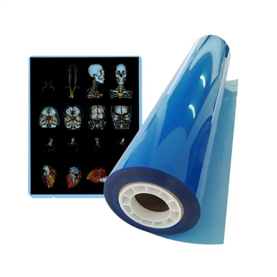 Thermischer medizinischer Trockendruckmaschine CT-Drucker Tintenstrahlfilm Blau A4 PET Orthopädische medizinische Ausrüstung Röntgenfilme
