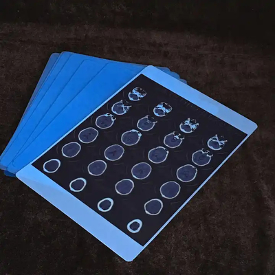 Erweiterte blaue medizinische Röntgenfilm für klare und genaue Bildgebung