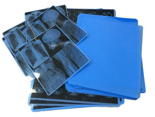 Blaue medizinische Röntgenfolie für Tintenstrahldrucker und klare und genaue Bildgebung