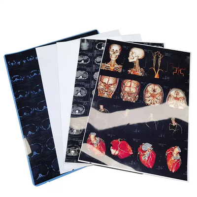 Tintaufstrahlmedizinischer Trockenfilm Transparenter blauer Röntgenfilm für CT-DR-MRT-Radiologiegerät